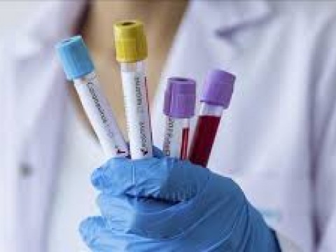 Casos de Coronavirus en el pa&iacute;s aumentan a 6,652 