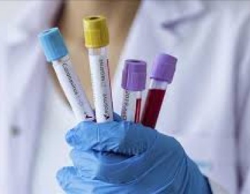 Para mediados de julio casos de Coronavirus podr&iacute;an reducirse al 100% afirman bioanalistas 