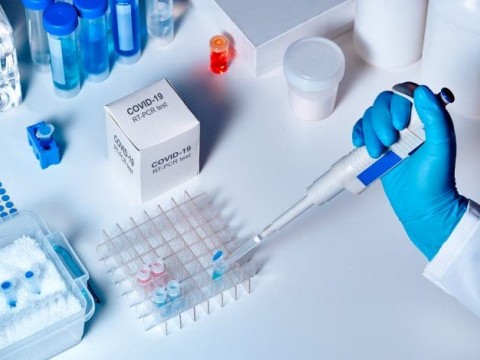 Ministro de Salud informa las 100 mil pruebas PCR ya est&aacute;n en el pa&iacute;s