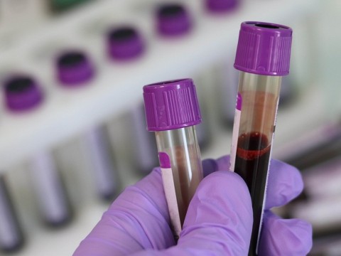 Conozca con qu&eacute; grupo sangu&iacute;neo es m&aacute;s probable contraer el coronavirus