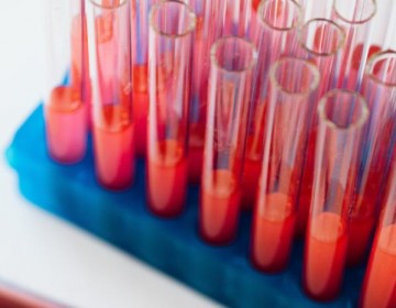 Un nuevo tratamiento reduce 74% avance de un raro c&aacute;ncer de sangre