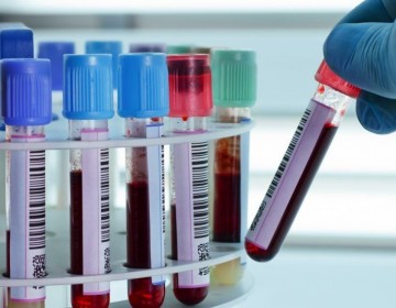 EEUU usar&aacute; la sangre de quienes superaron el COVID-19 para tratar a enfermos