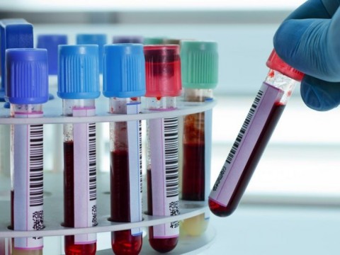EEUU usar&aacute; la sangre de quienes superaron el COVID-19 para tratar a enfermos