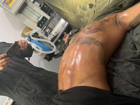 El Mayor Cl&aacute;sico dice que pocos urbanos admiten sus retoques tras someterse a una cirug&iacute;a est&eacute;tica