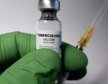 Desarrollan un mecanismo para hacer m&aacute;s eficaz la vacuna contra la tuberculosis