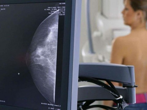 C&aacute;ncer de mama: las desigualdades socioecon&oacute;micas afectan la calidad de vida de las pacientes