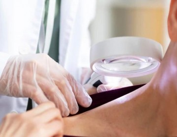 En el pa&iacute;s se diagnostican entre siete y ocho pacientes con c&aacute;ncer de piel cada d&iacute;a