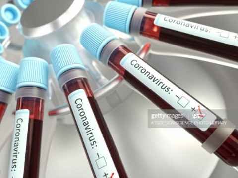 El Seguro Familiar de Salud cubrir&aacute; pruebas coronavirus indicadas por m&eacute;dicos