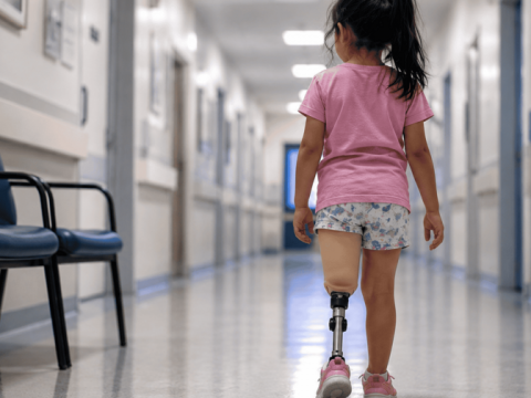 &laquo;Quiero mi pierna de vuelta&raquo;: El trauma de la infancia truncada por un accidente