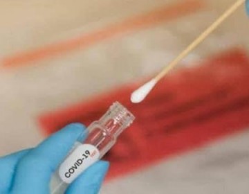 Salud P&uacute;blica reporta 328 nuevos casos de COVID-19 con el Gran Santo Domingo como principal foco