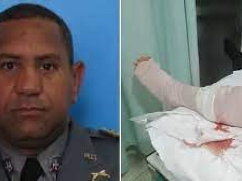 Hieren de bala a mayor PN en San Francisco Macor&iacute;s