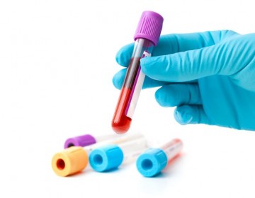 Inyectan 3,1 millones para diagnosticar el Alzheimer con an&aacute;lisis de sangre