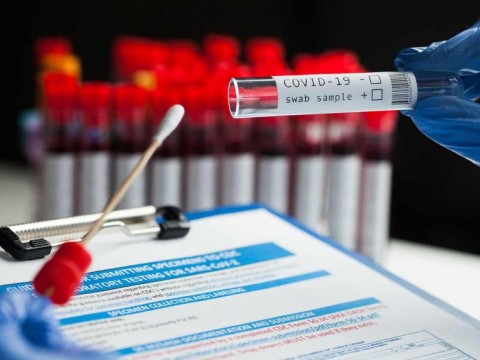 Un error en pruebas de covid en laboratorio brit&aacute;nico pudo causar 20 muertes
