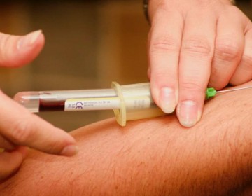 Un an&aacute;lisis de sangre para identificar un biomarcador del alzh&eacute;imer
