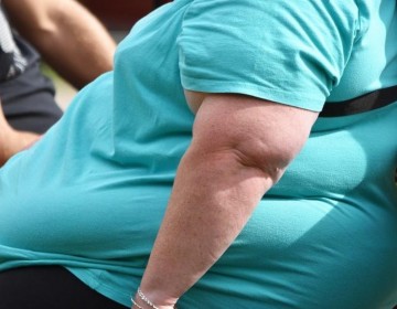 Hait&iacute; y RD ocupan primeros lugares en obesidad en AL