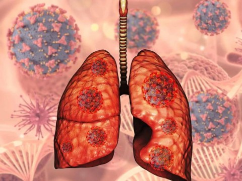 En el pa&iacute;s se detectan 4,000 casos de tuberculosis cada a&ntilde;o