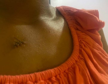 Hombre apu&ntilde;ala a madre de sus dos hijos en Hacienda Estrella