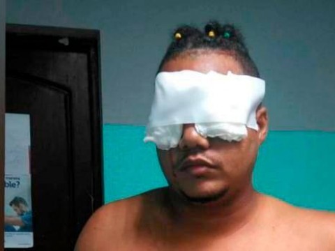 M&eacute;dicos podr&aacute;n salvar un ojo del joven que fue atacado con tijeras