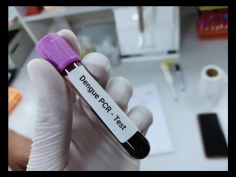 Realizan prueba PCR para agilizar resultados de muestra de dengue